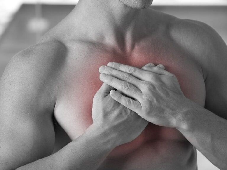 Dolor Muscular Pectoral